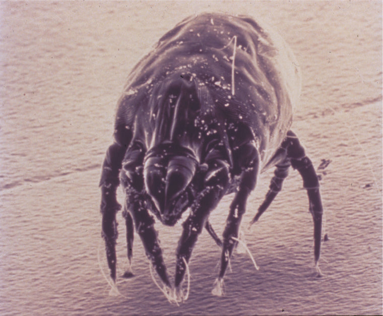 dust mite under the microscope